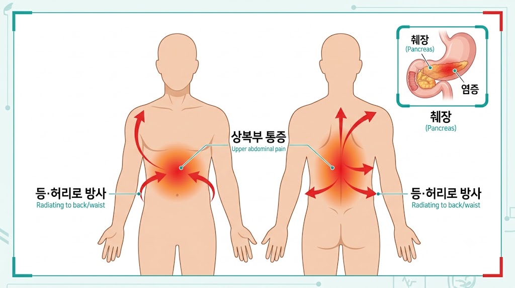 췌장염 증상 복통 부위 급성 만성 비교 일러스트