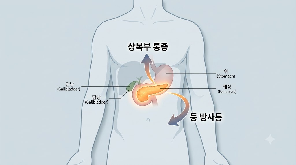 췌장염 증상 복통 위치와 방사통 방향을 보여주는 췌장 해부 일러스트