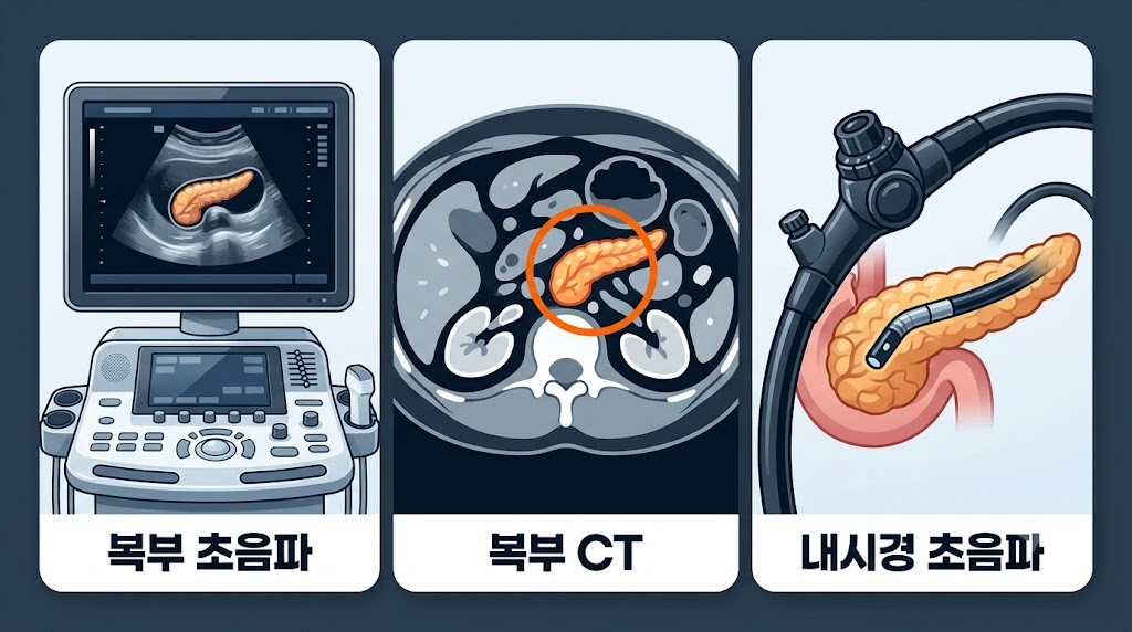 췌장질환 진단 CT MRI 내시경 초음파 검사 방법