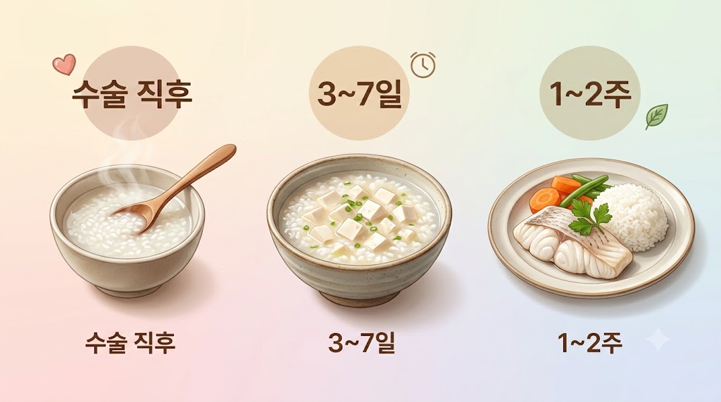 수술 직후 회복기 식단 구성 — 미음, 죽, 저지방 유동식 단계별 식사 일러스트