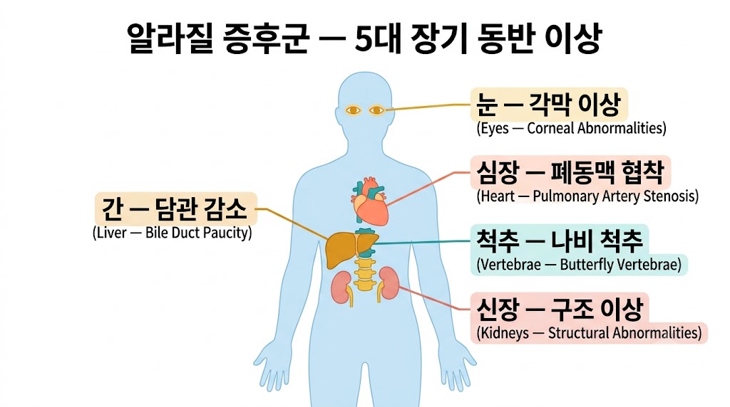 알라질 증후군 장기별 동반 이상 — 간 담관 부족·심장 기형·나비 척추·눈 이상·신장 문제