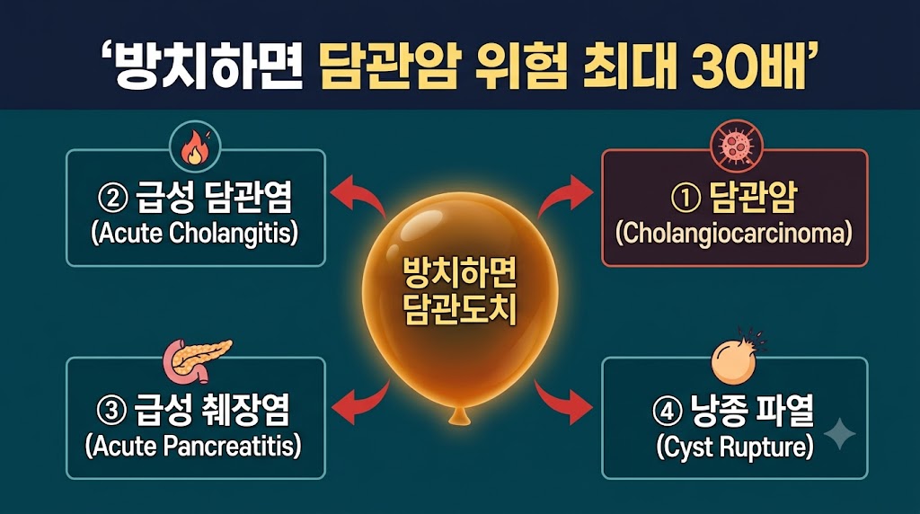 담즙성 낭종 방치 시 합병증 — 담관암, 담관염, 췌장염 위험 설명