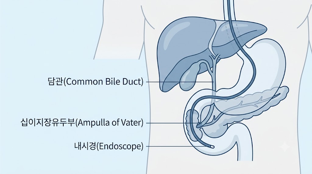 ERCP 시술 원리 — 담관 해부학 구조와 내시경 경로