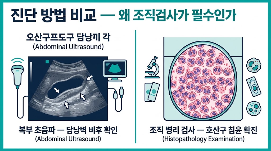 호산구성 담낭염 진단 — 초음파 검사와 조직검사 비교