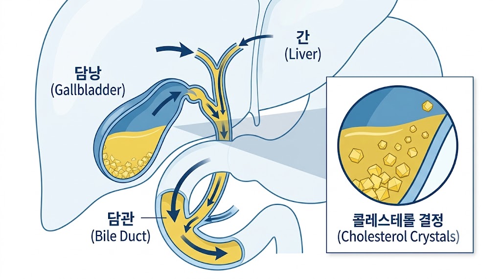 담낭에 영향 주는 약물과 담즙 흐름 변화 원리 의학 일러스트레이션
