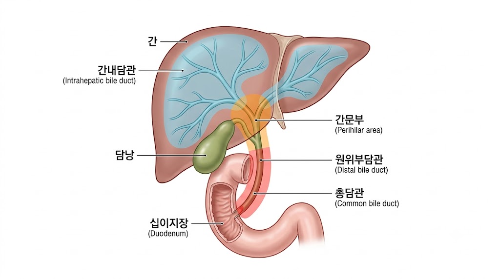 담관암 발생 위치별 분류 — 간내·간문부·원위부 담관암 해부학 도해