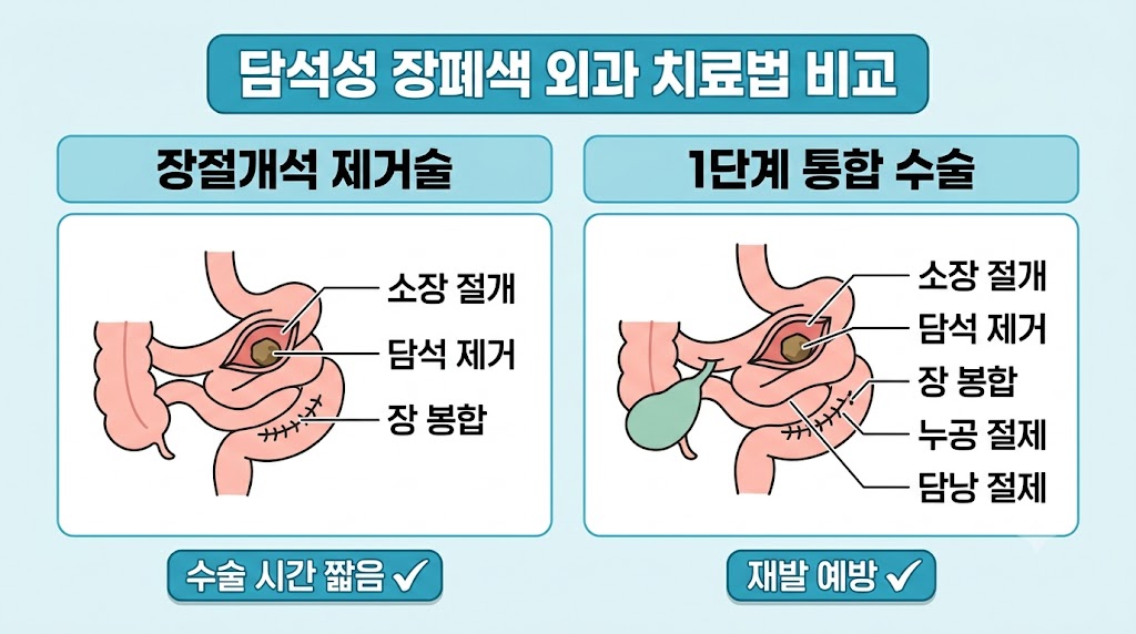 담석성 회장염 수술 방법 단계별 비교 일러스트