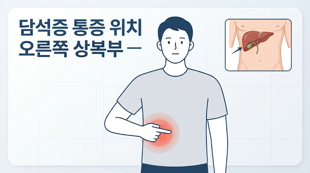 담낭 담석증 증상 — 오른쪽 상복부 담석 통증 위치 자가진단