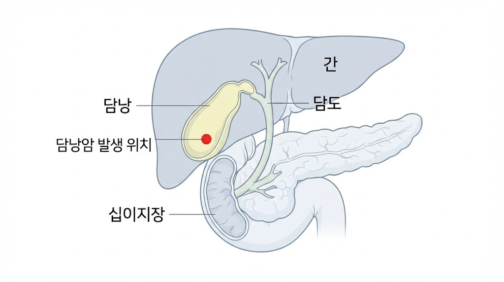  담낭암 발생 위치 — 담낭 구조와 담도계 해부학 일러스트