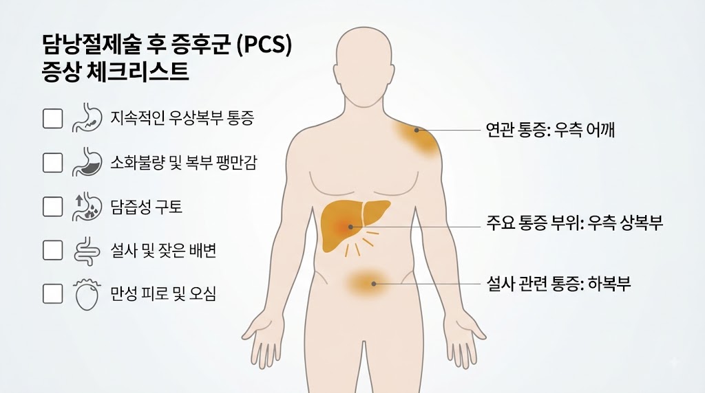 담낭절제술 후 증후군 자가진단 체크리스트 — 복부 통증 위치와 증상 확인 일러스트