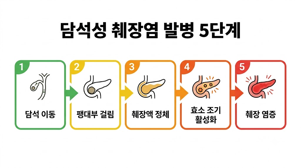 설명: 담석이 팽대부를 막아 췌장염이 시작되는 5단계 과정 인포그래픽