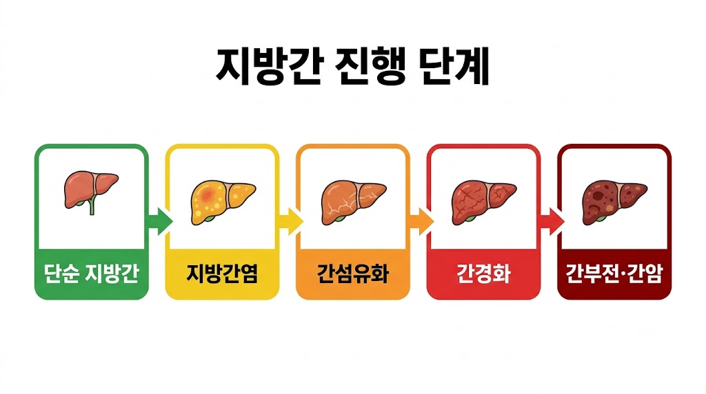 지방간에서 간경화까지 진행 단계 인포그래픽
