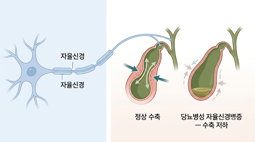 당뇨병성 자율신경병증 — 담낭 수축 기능 저하 매커니즘