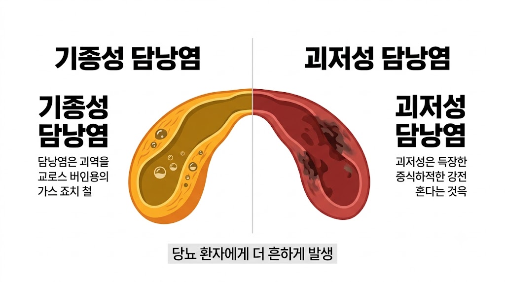 당뇨 환자 담낭염 합병증 — 기종성 담낭염과 괴저성 담낭염 비교